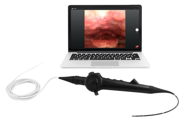 An example of USB Type Non-fiberoptic flexible video endoscope: Glimview&reg; Flexible Video Nasopharyngoscope, M3E