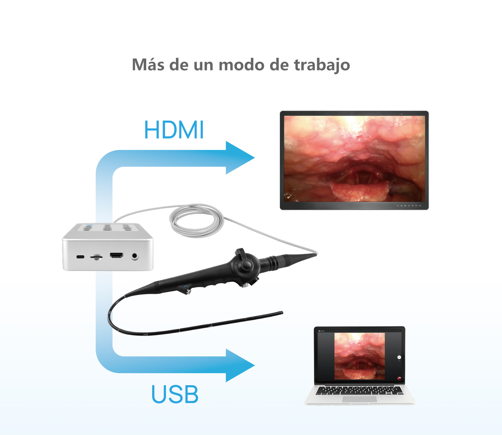 Videonasofaringoscopio Flexible M3E