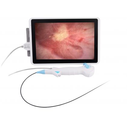 Ureteroscopio Flexible Desechable, DUR